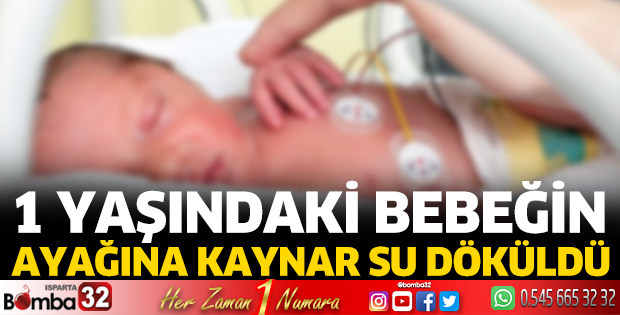 1 yaşındaki bebeğin ayağına kaynar su döküldü