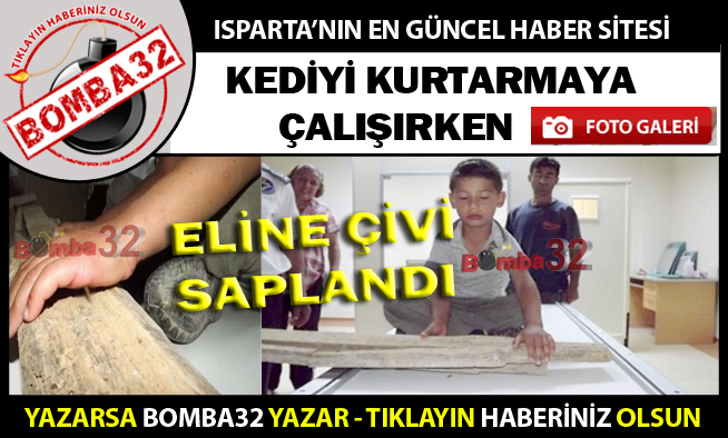 7 yaşındaki çocuğun  Eline çivili Tahta Saplandı