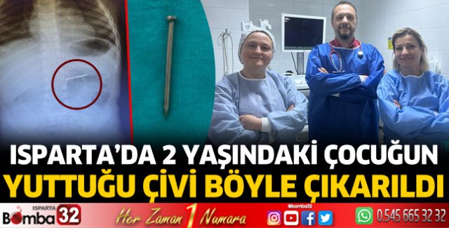 2 yaşındaki çocuğun yuttuğu çivi midesinden çıkarıldı