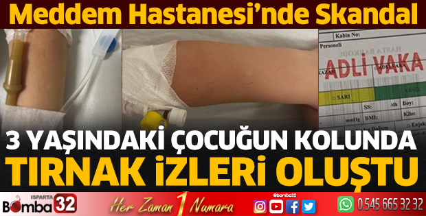 3 yaşındaki çocuğun kolunda tırnak izleri oluştu