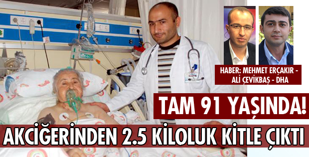 AKCİĞERİNDEN DEV KİTLE ÇIKTI