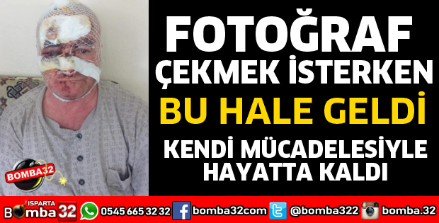 DAĞDA FOTOĞRAF ÇEKERKEN DÜŞTÜ