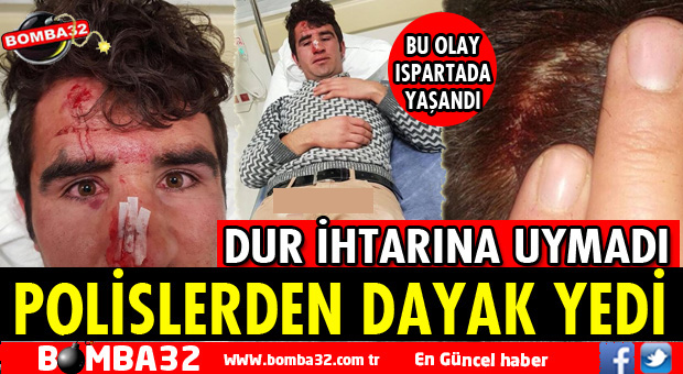 DUR İHTARINA UYMADI DAYAĞI YEDİ