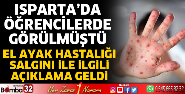 El Ayak Hastalığı salgını ile ilgili açıklama