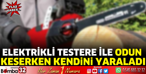 Elektrikli testere ile odun keserken kendini yaraladı. 