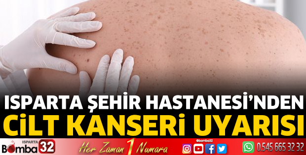 Isparta Şehir Hastanesi’nden Cilt Kanseri Uyarısı
