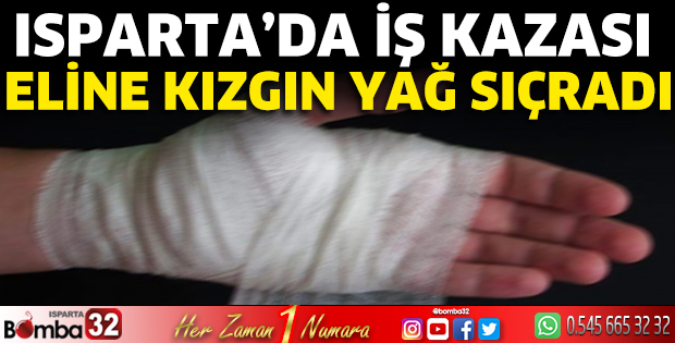 Isparta’da iş kazası eline kızgın yağ sıçradı 