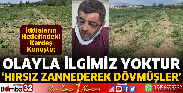 Köylüler hırsız zannederek dövmüşler