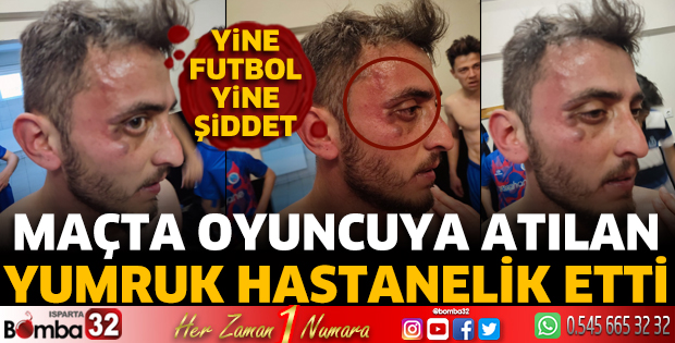 Maçta oyuncuya atılan yumruk hastanelik etti