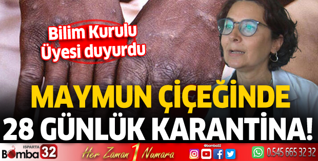Maymun çiçeğinde 28 günlük karantina! Bilim Kurulu üyesi duyurdu