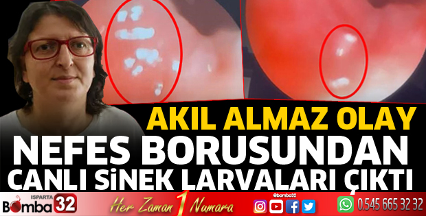 Nefes borusundan canlı sinek larvaları çıktı