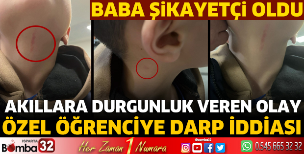 Özel öğrenciye darp iddiası