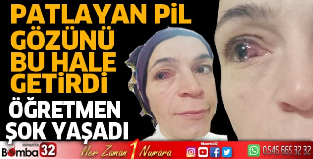 Patlayan pil gözünü bu hale getirdi