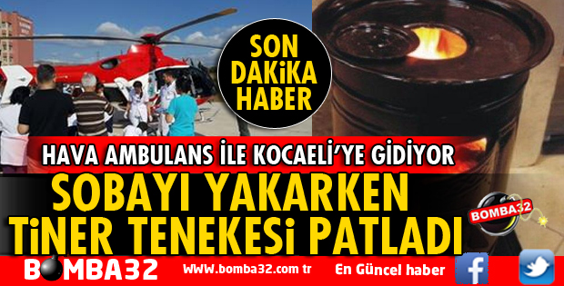 SOBAYI YAKMAK İSTERKEN TİNER ELİNDE PATLADI