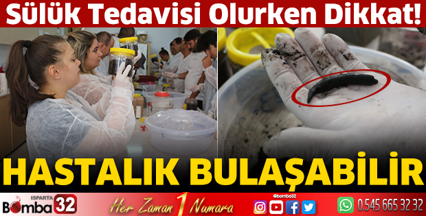Sülük tedavisi olurken dikkat!