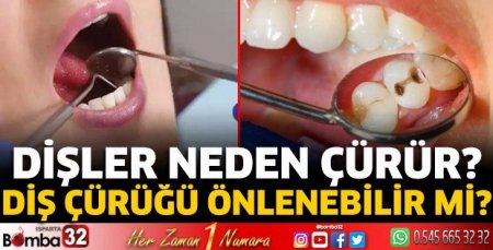  İl Sağlık Müdürlüğü duyurdu: Dişler neden çürür?