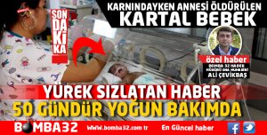  KARTAL BEBEK 50 GÜNDÜR YOĞUN BAKIMDA