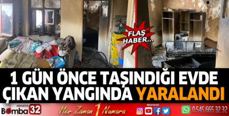 1 gün önce taşındığı evde çıkan yangında yaralandı