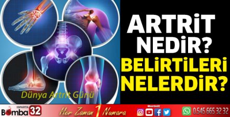 12 Ekim Dünya Artrit Günü