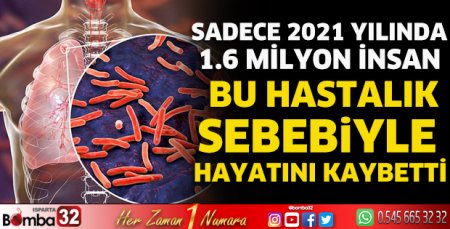 24 Mart Dünya Tüberküloz Günü