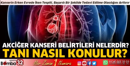 Akciğer Kanseri belirtileri nelerdir?