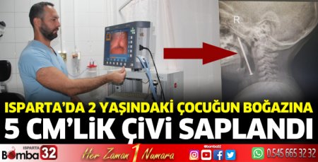 Boğazına saplanan 5 santimetrelik çivi çıkarıldı