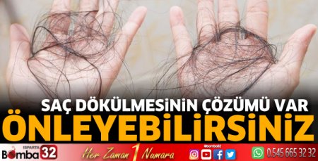 Bu yöntemlerle saç dökülmesini önleyebilirsiniz