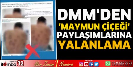 DMM'den 'maymun çiçeği' paylaşımlarına yalanlama