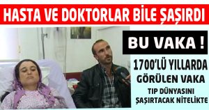 Doktorlar bile şaşırdı