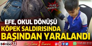 Efe, okul dönüşü köpek saldırısında başından yaralandı