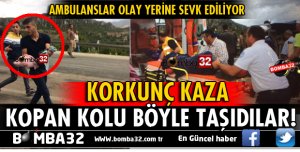 FECİ KAZADA KOPAN KOLU İŞTE BÖYLE TAŞIDILAR