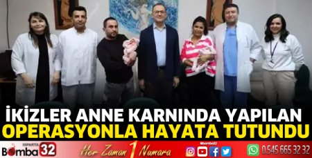 İkizler anne karnında yapılan operasyonla hayata tutundu