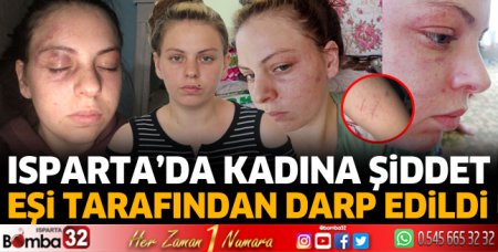 Isparta'da eşinden darp gören kadın şikayetçi oldu