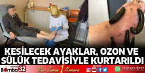 Kesilecek ayaklar, Ozon ve sülük tedavisiyle kurtarıldı