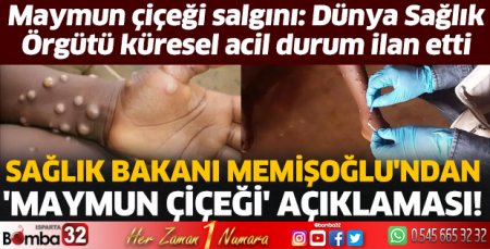 Maymun Çiçeği salgını 