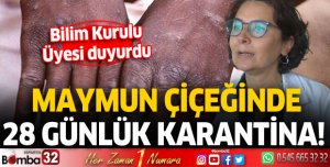 Maymun çiçeğinde 28 günlük karantina! Bilim Kurulu üyesi duyurdu