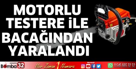 Motorlu testere ile bacağından yaralandı