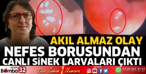 Nefes borusundan canlı sinek larvaları çıktı