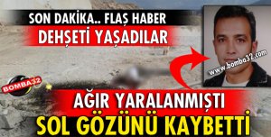 O İŞÇİNİN DURUMU AĞIR