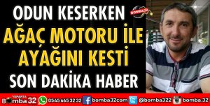 ODUN KESERKEN AYAĞINI KESTİ