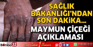 Sağlık Bakanlığı'ndan Maymun Çiçeği açıklaması