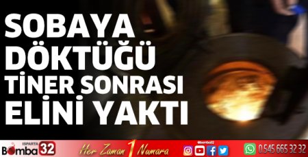 Sobaya döktüğü tiner sonrası elini yaktı