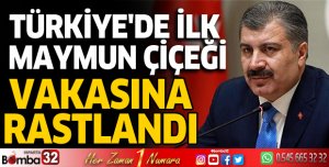Türkiye'de ilk maymun çiçeği vakasına rastlandı