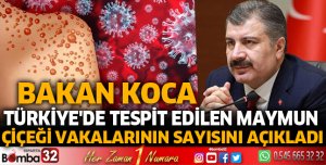 Türkiye'de tespit edilen Maymun Çiçeği vakalarının sayısını açıkladı