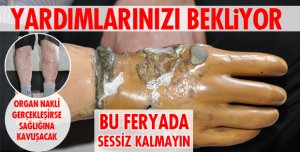 YARDIM BEKLİYOR!