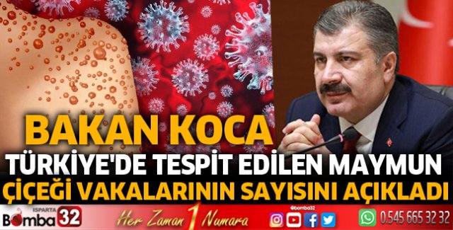 Türkiye'de tespit edilen Maymun Çiçeği vakalarının sayısını açıkladı