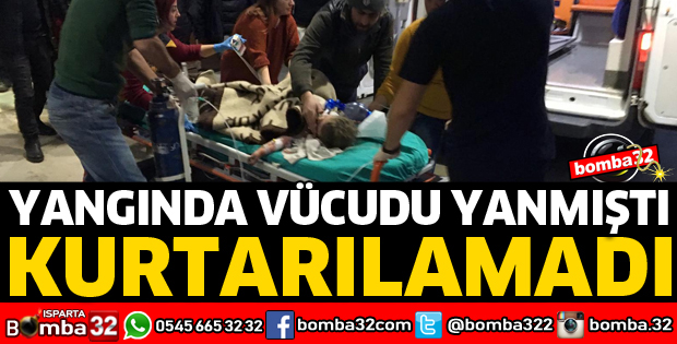 YANGINDA VÜCUDU YANMIŞTI, KURTARILAMADI
